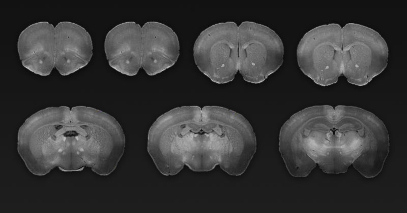 Mouse brain segments